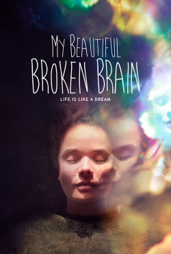 My Beautiful Broken Brain-123movies